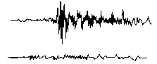 Signal klopfsensor.gif